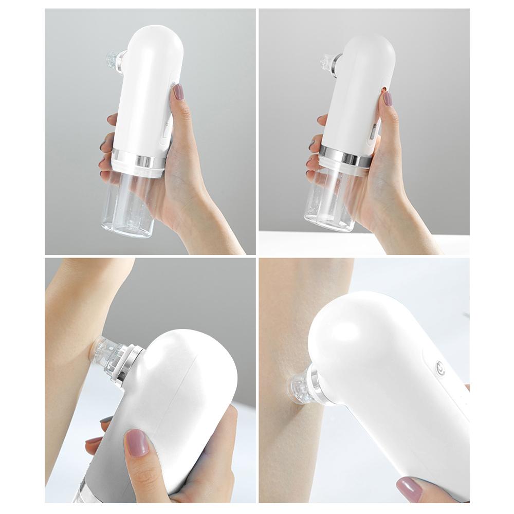 Water Cycled Blackhead Remover & Microdermabrasion Tool