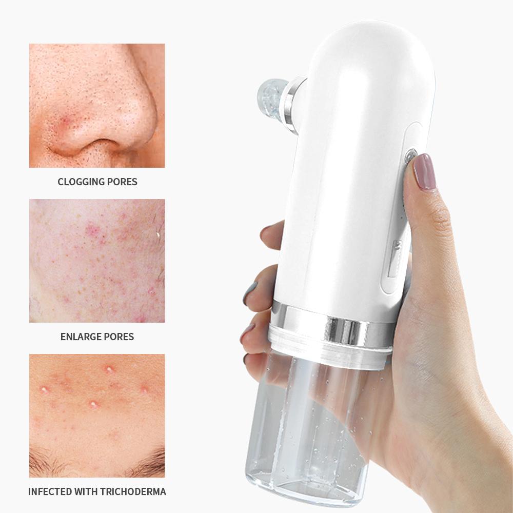 Water Cycled Blackhead Remover & Microdermabrasion Tool